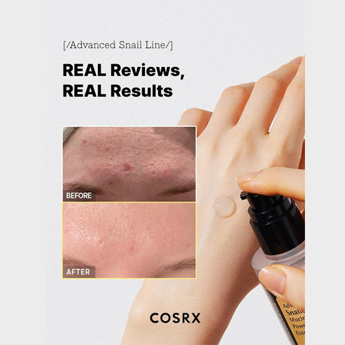 COSRX Advanced Snail 96 Mucin Essence | Hydrating & Skin Repair